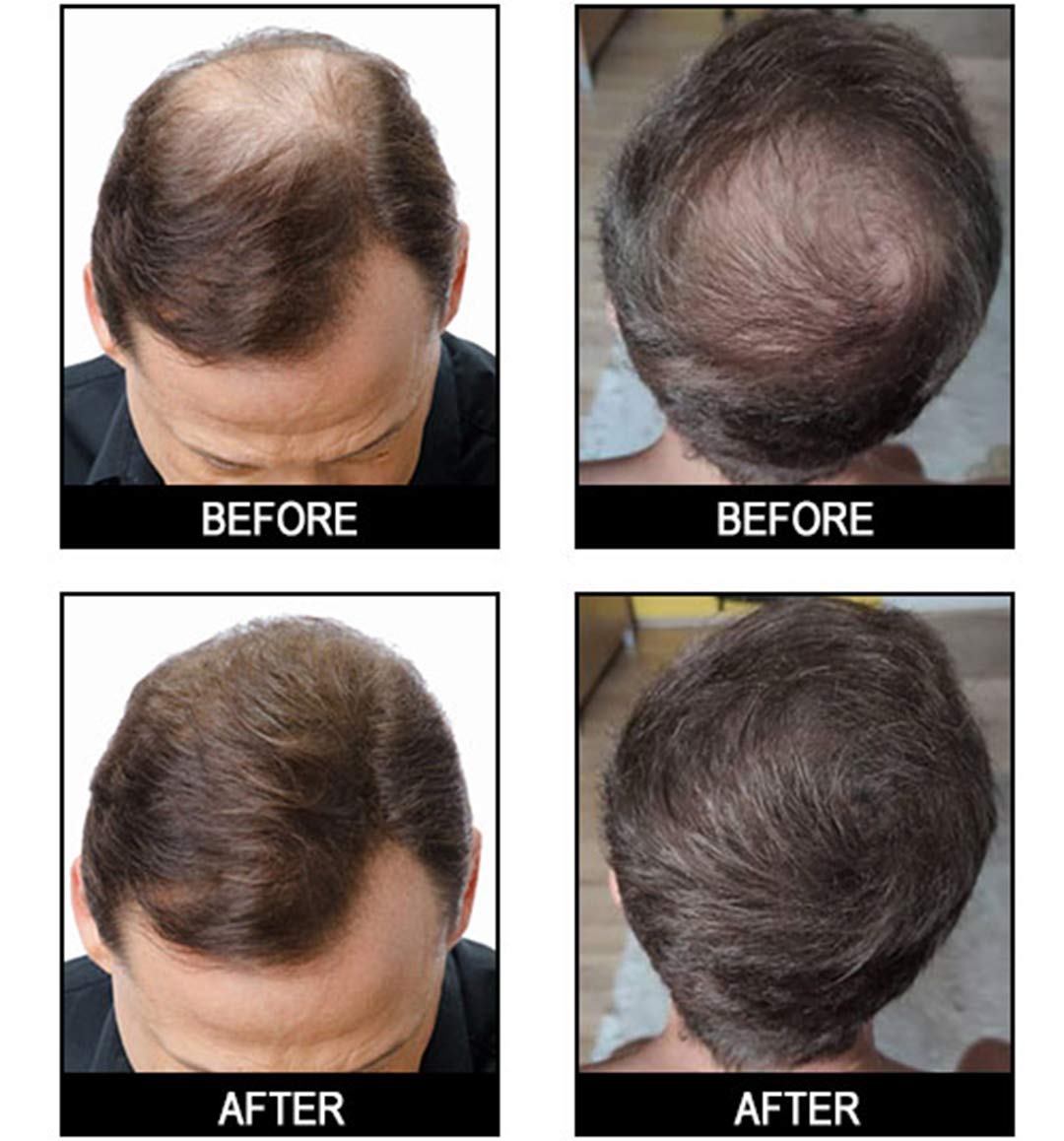 Hair Fibers Hair Building Fibers Undetectable Hair Fuller Thicker,Instantly Cover Sparse Hair 25g/0.88oz (black)