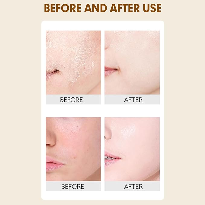 Rice Exfoliating Ampoule Set, White Black Rice Exfoliant Serum, Body and Face Exfoliator, Peeling Ampoule & Dead Skin Remover - Gentle Peel and Pore Minimizing & Deep Hydration