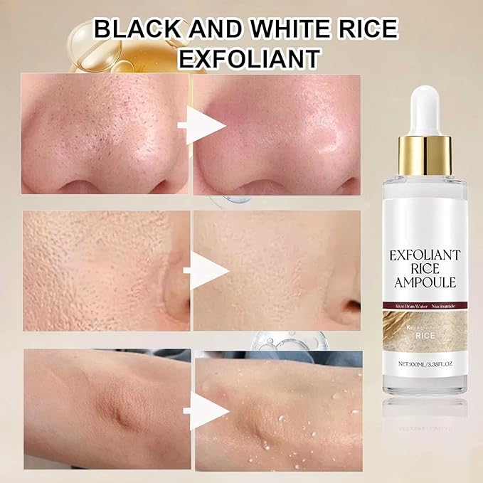 2PCS Peel Shot, Black and White Rice Peeling Ampoule, Rice Ampoule Duo Exfoliating Solution | Moisturizes and Nourishes for a Healthy Glow | Gentle Peel + Pore Minimizer for Face