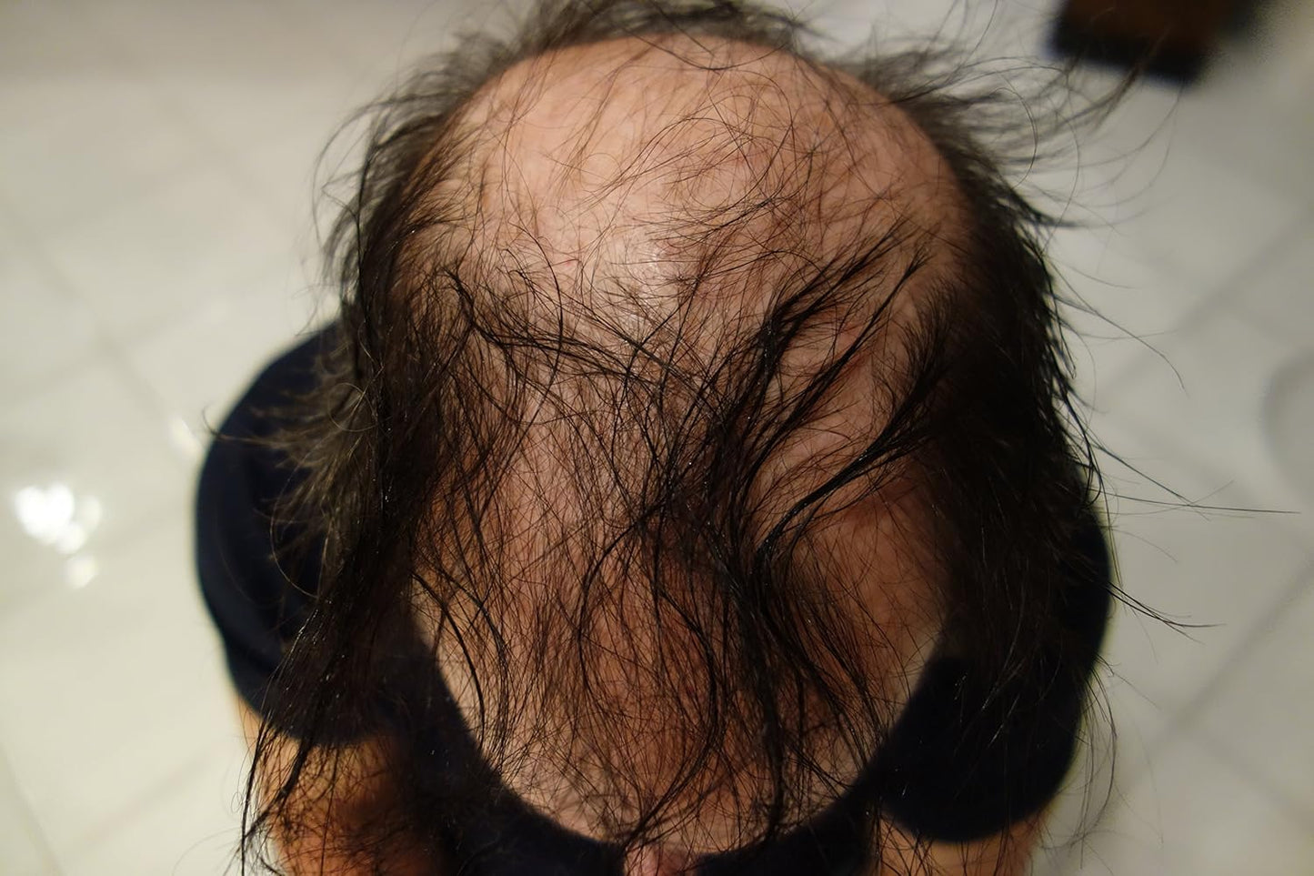 New Hair Building Fibers 100+14=114 Grams. Highest Grade Refill That You Can Use for Your Bottles From Competitors Like Toppik, Xfusion, Efficient (Dark Chocolate Brown)