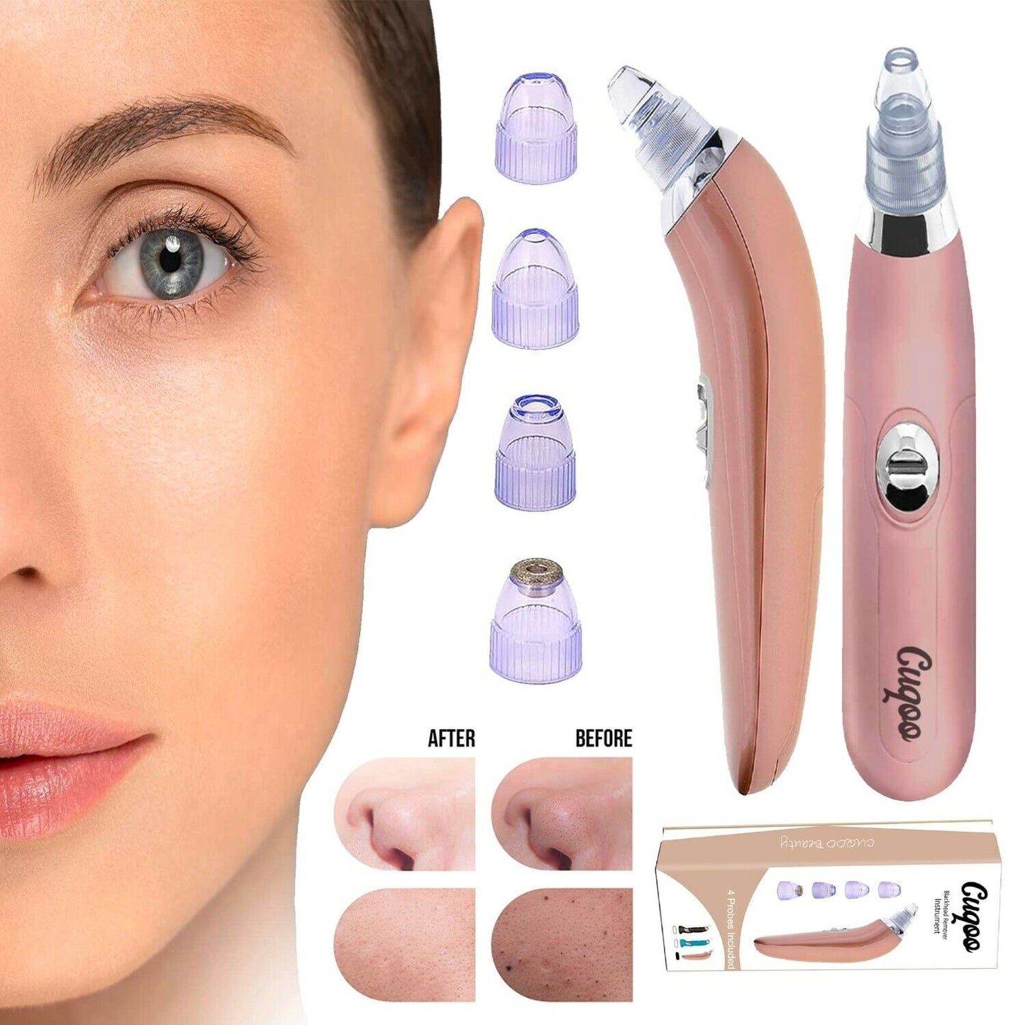 Blackhead Remover Vacuum Acne Cleaner Black Spots Removal